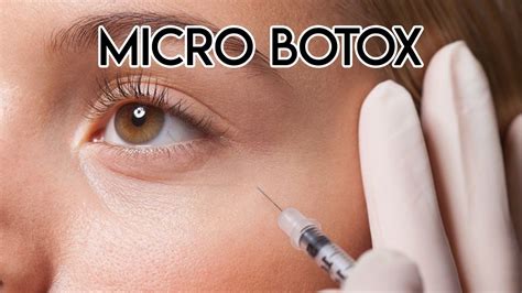 Micro Botox Youtube