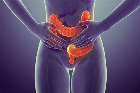Though not preventable, colon cancer has a high cure rate when discovered early. Colon Cancer: Signs, Symptoms, and Complications
