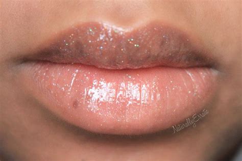 Sun Spots On Lips Pictures