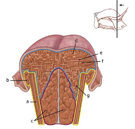 Tongue Musculature Coronal View Illustrating Fsus Involved In Tongue