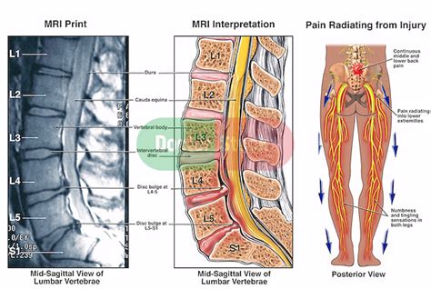 Spinal Column Nerves