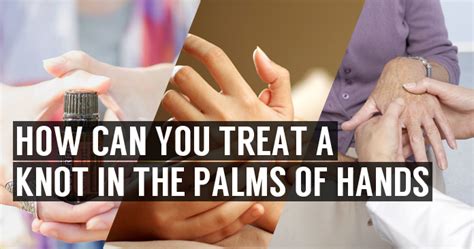 Knots And Lump In Palm Of Hands Symptoms And Home Treatment