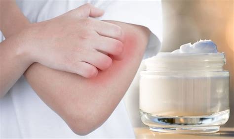Eczema Treatment Prevent Dry And Itchy Skin Condition With Vitamin E