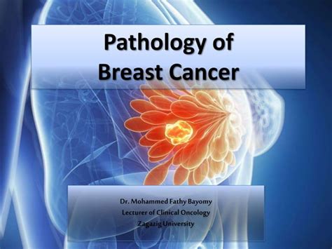 Pathology Of Breast Cancer Ppt