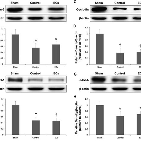Expression Of Tight Junction Tj Proteins In A Rat Model Of Mcao