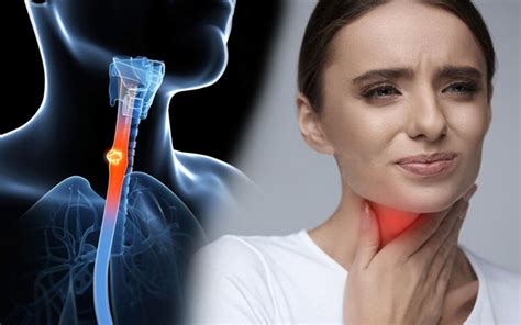 6 Of The Most Common Symptoms Of Throat Cancer That You Shouldnt Ignore Health Advice Page 5
