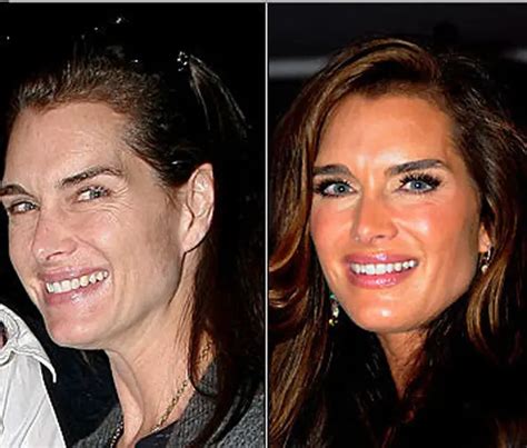 Brooke Shields Plastic Surgery Before And After Botox Injections Celebie Gambaran