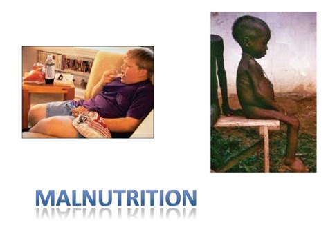 Obesity And Malnutrition An International Perspective Of The Paradox