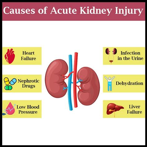 Causes Of Acute Kidney Failure Acute Kidney Injury Signs Of Kidney