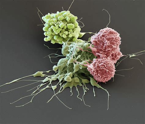 Adenocarcinoma Cells Sem Photograph By Oliver Meckes Eye Of Science
