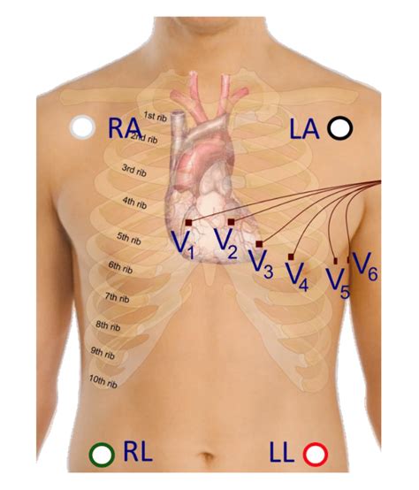 2 Electrode Placement For Electrocardiogram Ecg