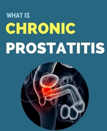 What Is The Best Treatment For Chronic Prostatitis