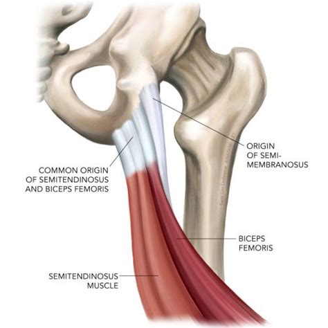A Pain In The Butt Understanding Proximal Hamstring Tendinopathy And