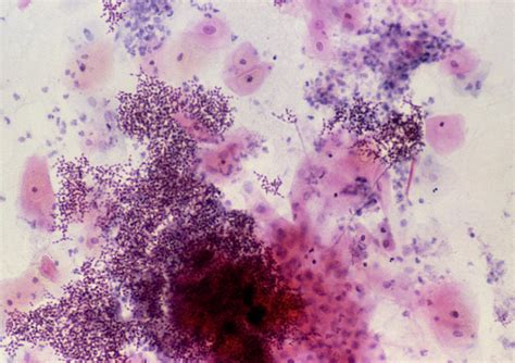 Lm Of A Cervical Smear Showing Candida Albicans Photograph By Science