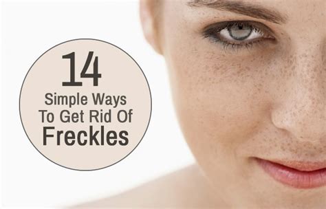 12 Home Remedies To Get Rid Of Freckle On Face Getting Rid Of