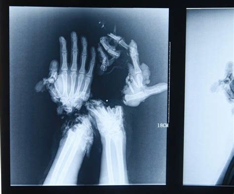 10 Shocking X Rays That Are Unbelievably Real