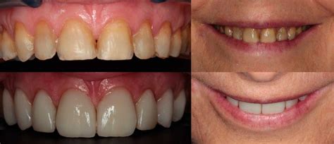 Simple Science: How to Make a Volcano with Kids