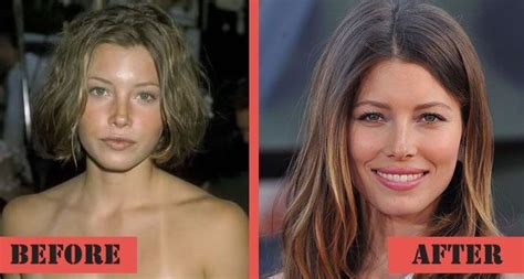 Jessica Biel Before And After Plastic Surgery Celebrity Plastic Surgery Online