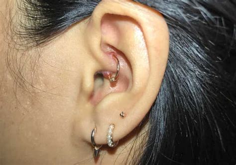 How To Treat An Infected Daith Piercing