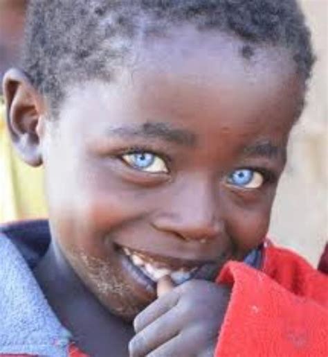 Un Garçon Noir Zimbabwéen Avec Les Yeux Bleus Black With Blue Eyes