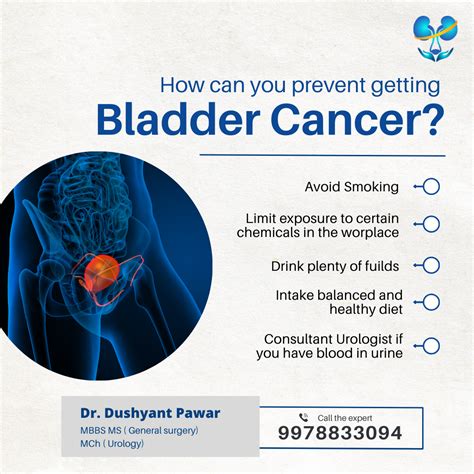 How Can You Prevent Getting Bladder Cancer Urologist Ahmedabad