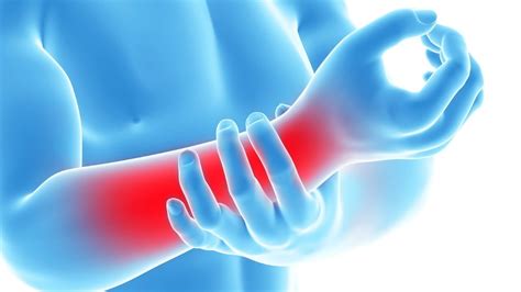 Arm Pain Causes And Effective Treatment Youtube
