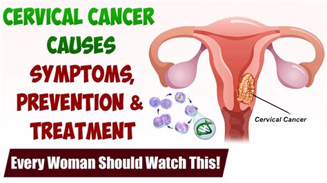 Despite many advances in the diagnosis and treatment of gynecological inflammatory diseases (gid), the epidemic of gids continues unabated. Cervical Cancer: Causes, Symptoms, Prevention & Treatment ...