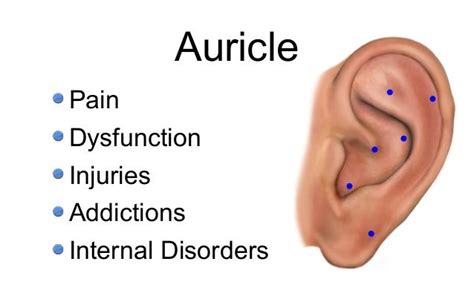Auriculotherapy Overview
