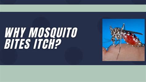 Why Do Mosquito Bites Itch Youtube