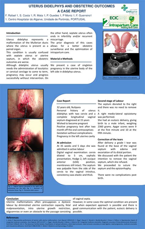 Pdf Uterus Didelphys And Obstetric Outcomes A Case Report
