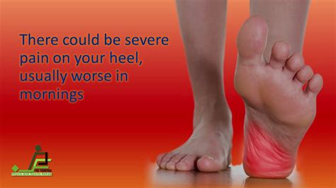 Effective Physiotherapy Treatment And Exercises For Plantar Fasciitis
