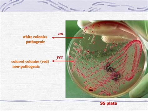 Ppt Enteric Gram Negative Rods Enterobacteriaceae Powerpoint