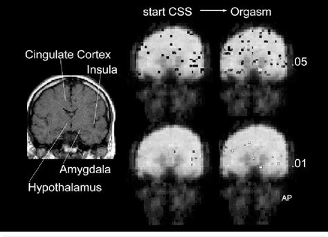 figure 4 from functional mri of the brain during orgasm in women semantic scholar