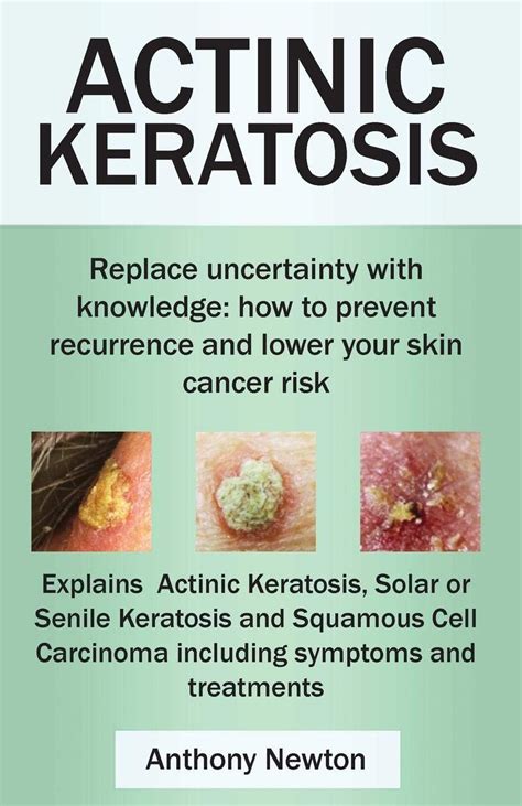 Actinic Keratosis Replace The Fear And Uncertainty With Knowledge How