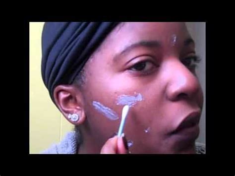 Apply bleaching cream only on the area you wish to make lighter. How To Properly Treat Dark Spots w/ Fade Cream (Bleaching ...