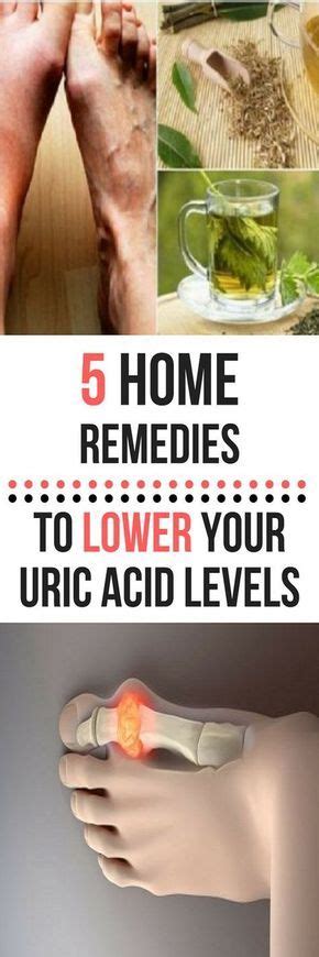 5 Home Remedies To Lower Your Uric Acid Levels Fitness Fiesta