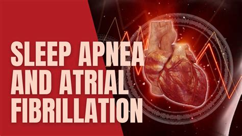 How Does Sleep Apnea Affect Atrial Fibrillation Youtube