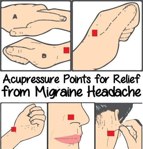 Acupressure Points For Relief From Migraine Headache Acupressure Points Migraine Headaches