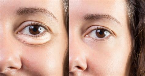 Pure Biology Moisturizing Eye Cream Can Seriously Reduce Puffiness