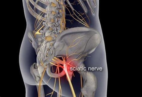 Lower back is a very important part of the back. Lower Back Pain: Symptoms, Stretches, Exercise for Pain Relief