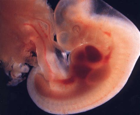 Le foetus à 3 mois. embryologie