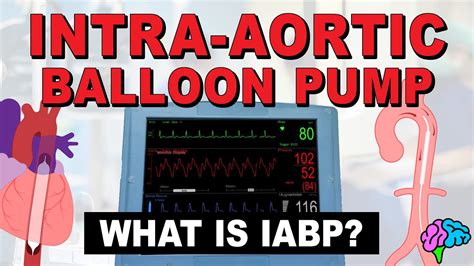 What Is An Intra Aortic Balloon Pump IABP YouTube