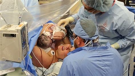 Watch A C Section Delivery St Luke’s Birthing Center