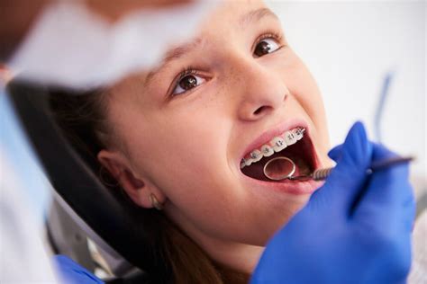 The Top 6 Benefits Of Orthodontic Treatment Jorge B Lowe