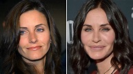 Courtney Cox Plastic Surgery Before And After Botox Cosmetic Procedures ...
