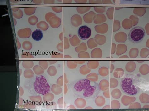 Lymphocytes And Monocytes 1 Lymphocytes And Monocytes 1 Flickr