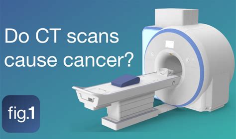 Does Radiation Exposure From Ct Scans Increase Your Risk Of Cancer