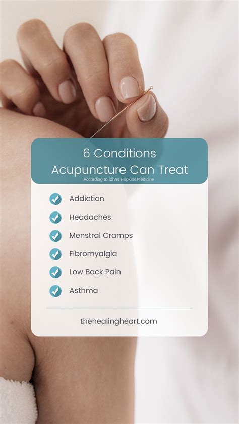 About Acupuncture At The Healing Heart The Healing Heart