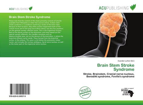 Inspired with leonard 10 trigeminal complex of the brainstem is general sensory nucleus complex. Bookbrain Stem Nuclei / Brainstem Png Images Klipartz ...