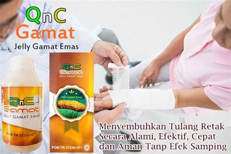 Tapi tahukah kamu bahwa ada cara mengobati sengatan lebah yang ampuh dan mempercepat. Kita Bersama Herbal
